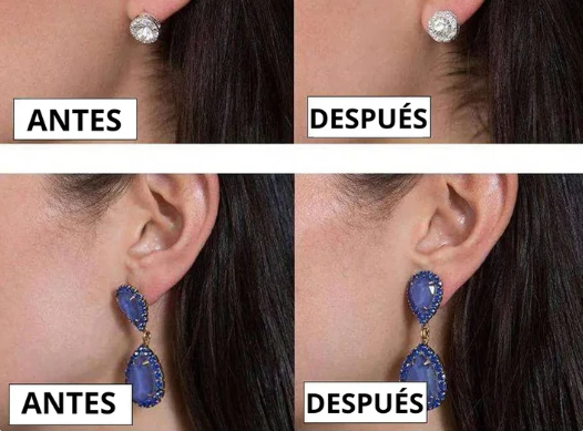 💎EARLIFTPRO: CIERRE ELEVADOR DE ARETES x2