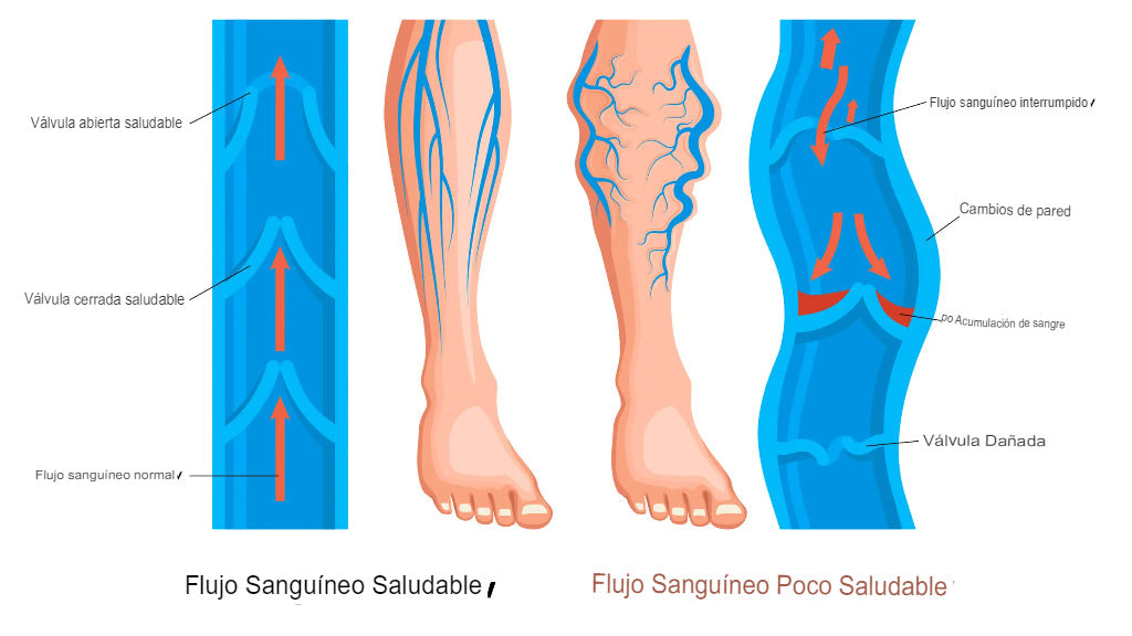 ProCompress: medias de compresión graduables🧦💪