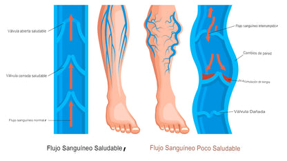 ProCompress: medias de compresión graduables🧦💪